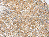 Anti-Human/Mouse MBOAT4 Antibody - ABMIUM