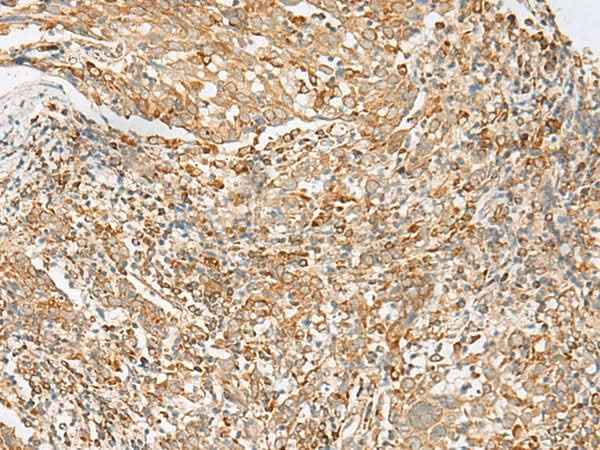 Anti-Human/Mouse MBOAT4 Antibody