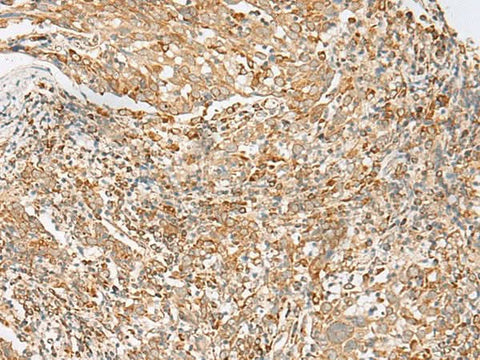Anti-Human/Mouse MBOAT4 Antibody - ABMIUM