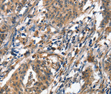 Anti-Human/Mouse/Rat ALOX15 Antibody - ABMIUM