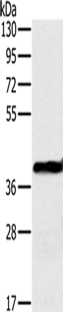 Anti-Human/Mouse/Rat OTC Antibody - ABMIUM