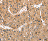 Anti-Human ATG12 Antibody - ABMIUM
