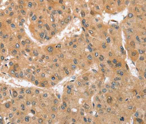 Anti-Human ATG12 Antibody