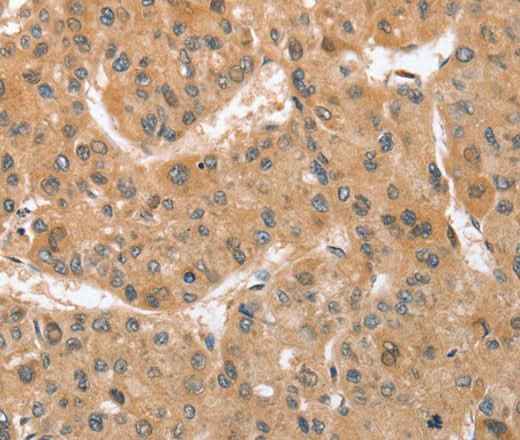 Anti-Human ATG12 Antibody