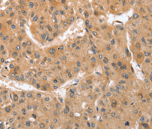 Anti-Human ATG12 Antibody - ABMIUM