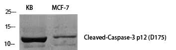 Western Blot analysis of KB cells using Cleaved-CASP3 p12 (D175) Polyclonal Antibody at dilution of 1:1000.