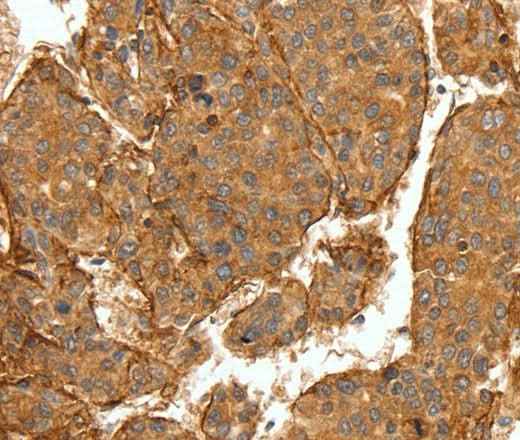 Anti-Human/Mouse COL4A1 Antibody