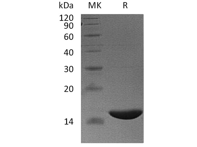 Recombinant Human FABP6/I-BABP Protein (His Tag) - ABMIUM