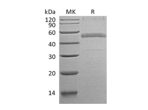 > 82 % as determined by reducing SDS-PAGE.