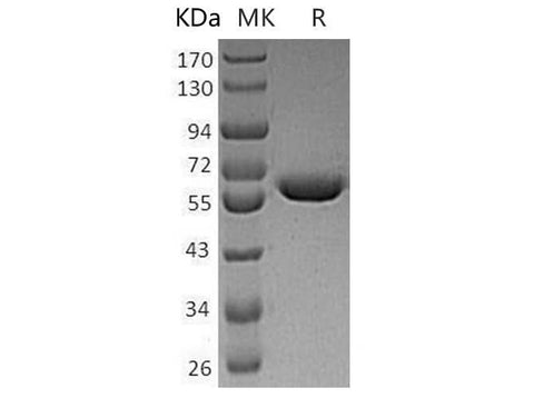 Recombinant Human WARS/TrpRS Protein (His Tag) - ABMIUM