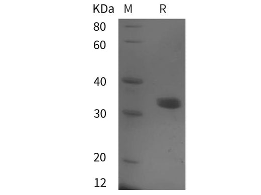 SDS-PAGE analysis of Human MCM5 proteins, 2 μg/lane of Recombinant Human MCM5 proteins was resolved with SDS-PAGE under reducing conditions, showing bands at 35 kDa.