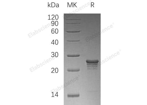 Recombinant Human Phosphomevalonate Kinase/PMVK Protein (His Tag) - ABMIUM