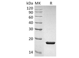 Recombinant Human IL-1RA/IL1RN Protein - ABMIUM