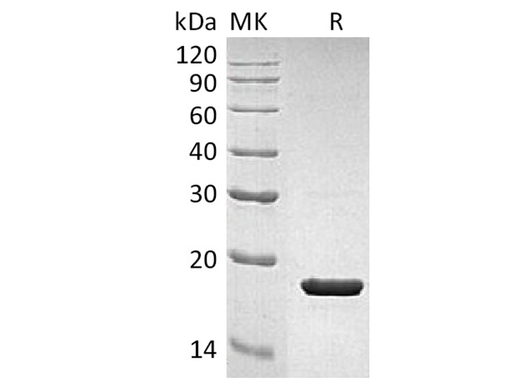 Recombinant Human IL-1RA/IL1RN Protein - ABMIUM