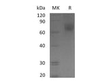 Recombinant Human EGFR/ErbB1 Protein (His Tag) - ABMIUM