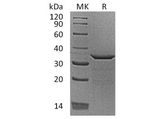 Recombinant Human Proenkephalin-B/PDYN Protein (His Tag) - ABMIUM