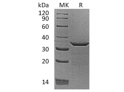 Recombinant Human Proenkephalin-B/PDYN Protein (His Tag) - ABMIUM