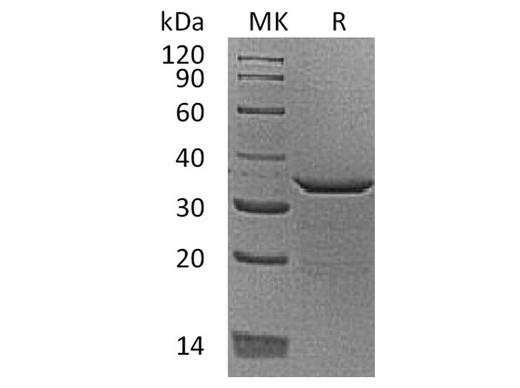 Recombinant Human Proenkephalin-B/PDYN Protein (His Tag) - ABMIUM