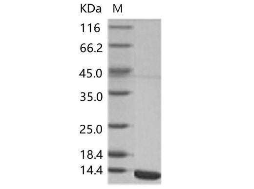 Recombinant WNV (lineage 2, strain Nea Santa-Greece-2010) E / Envelope Protein (Domain III, His Tag) - ABMIUM