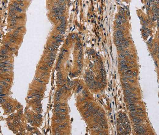 Anti-Human/Mouse/Rat ITPR1 Antibody