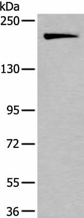Western blot analysis of HUVEC cell lysate using IQGAP1 Polyclonal Antibody at dilution of 1:300