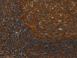 Anti-Human/Mouse/Rat MIP Antibody - ABMIUM