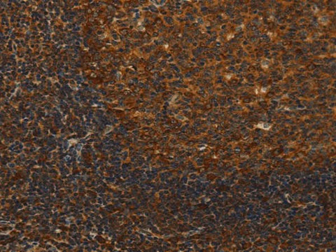 Anti-Human/Mouse/Rat MIP Antibody - ABMIUM