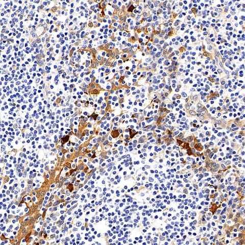 Immunohistochemistry analysis of paraffin-embedded human tonsil tissue using Galectin 3 Monoclonal Antibody at dilution of 1:400.