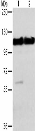 Anti-Human/Mouse ACTN2 Antibody - ABMIUM