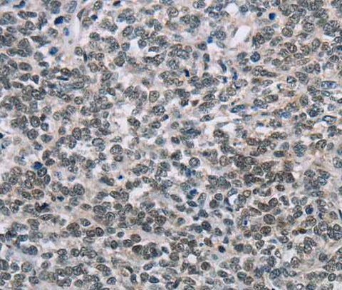 Anti-Human TONSL Antibody