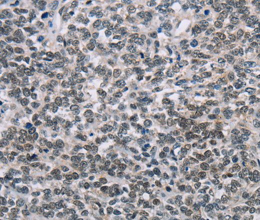 Anti-Human TONSL Antibody - ABMIUM
