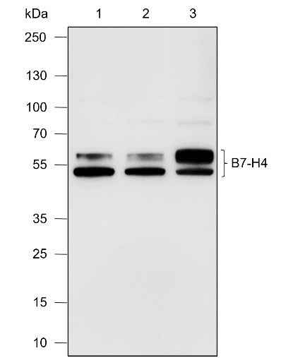 Anti-Human B7-H4 Antibody [A588] - ABMIUM