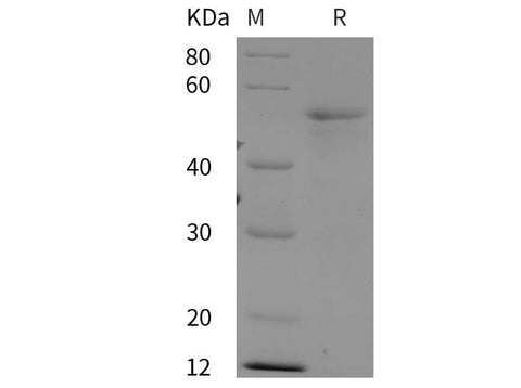 SDS-PAGE analysis of Human Ataxin-3/ATXN3 proteins, 2 μg/lane of Recombinant Human Ataxin-3/ATXN3 proteins was resolved with SDS-PAGE under reducing conditions, showing bands at 50 kDa.