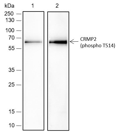 Anti-Rat Phospho-CRMP2 (Thr514) Antibody [A793] - ABMIUM