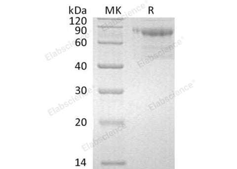 Recombinant Human SerpinA10/SERPINA10 Protein (His Tag) - ABMIUM