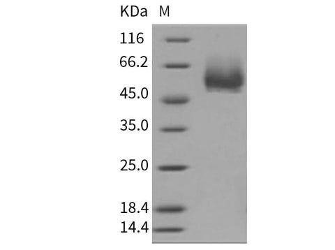 Recombinant Mouse CD4/LEU3 Protein (His Tag) - ABMIUM