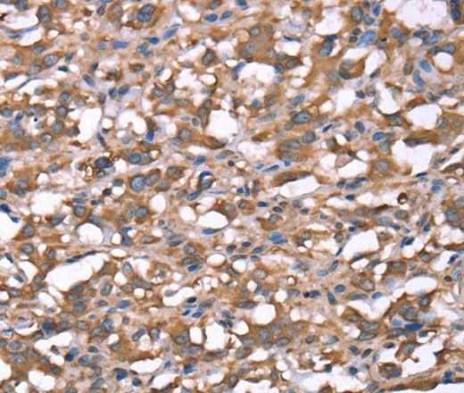 Anti-Human/Mouse/Rat SPAST Antibody