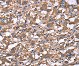 Anti-Human/Mouse/Rat SPAST Antibody - ABMIUM