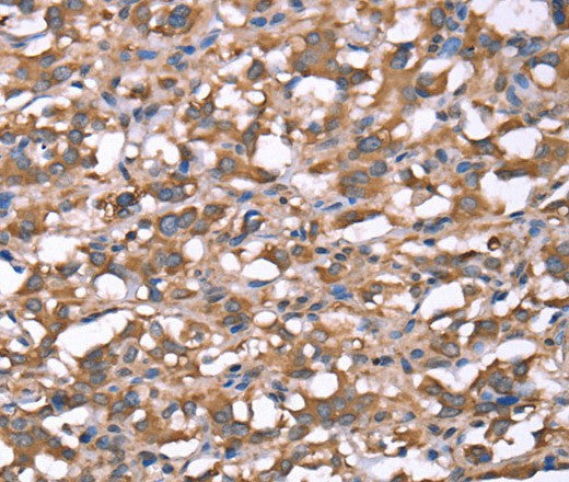 Anti-Human/Mouse/Rat SPAST Antibody - ABMIUM