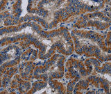 Anti-Human KLK11 Antibody - ABMIUM