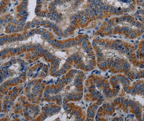 Anti-Human KLK11 Antibody