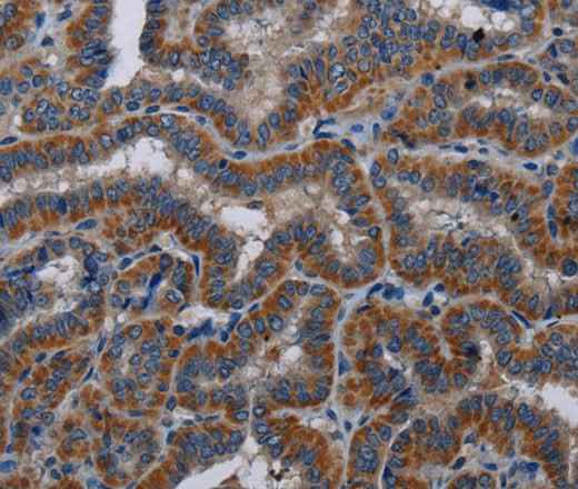 Anti-Human KLK11 Antibody