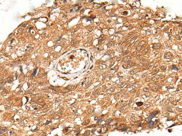 Anti-Human/Mouse/Rat KLHL36 Antibody