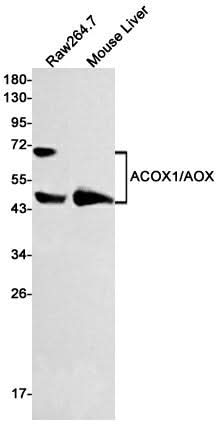Western blot detection of ACOX1/AOX in Raw264.7,Mouse Liver cell lysates using ACOX1/AOX Rabbit mAb(1:500 diluted).Predicted band size:74kDa.Observed band size:74,48kDa.