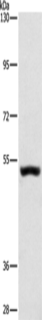 Anti-Human/Mouse/Rat SYT17 Antibody - ABMIUM