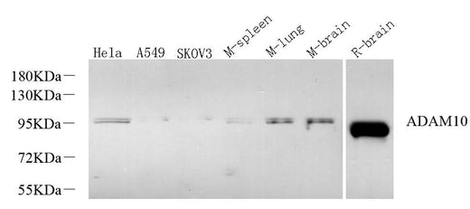 Western Blot analysis of various samples using CD156c Polyclonal Antibody at dilution of 1:600.