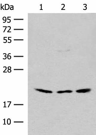 Western blot analysis of HEPG2 and Hela cell Mouse liver tissue lysates using RPL23A Polyclonal Antibody at dilution of 1:300