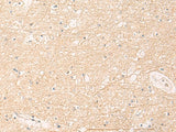 Immunohistochemistry of paraffin-embedded Human brain tissue using ELP1 Polyclonal Antibody at dilution of 1:30(×200)