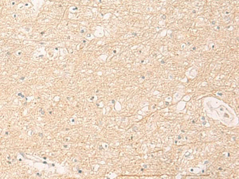 Immunohistochemistry of paraffin-embedded Human brain tissue using ELP1 Polyclonal Antibody at dilution of 1:30(×200)