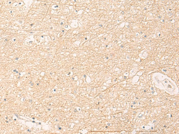 Immunohistochemistry of paraffin-embedded Human brain tissue using ELP1 Polyclonal Antibody at dilution of 1:30(×200)
